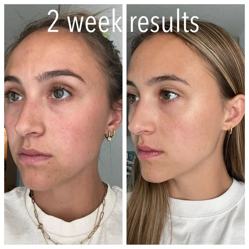 Beef Tallow Facial Balm